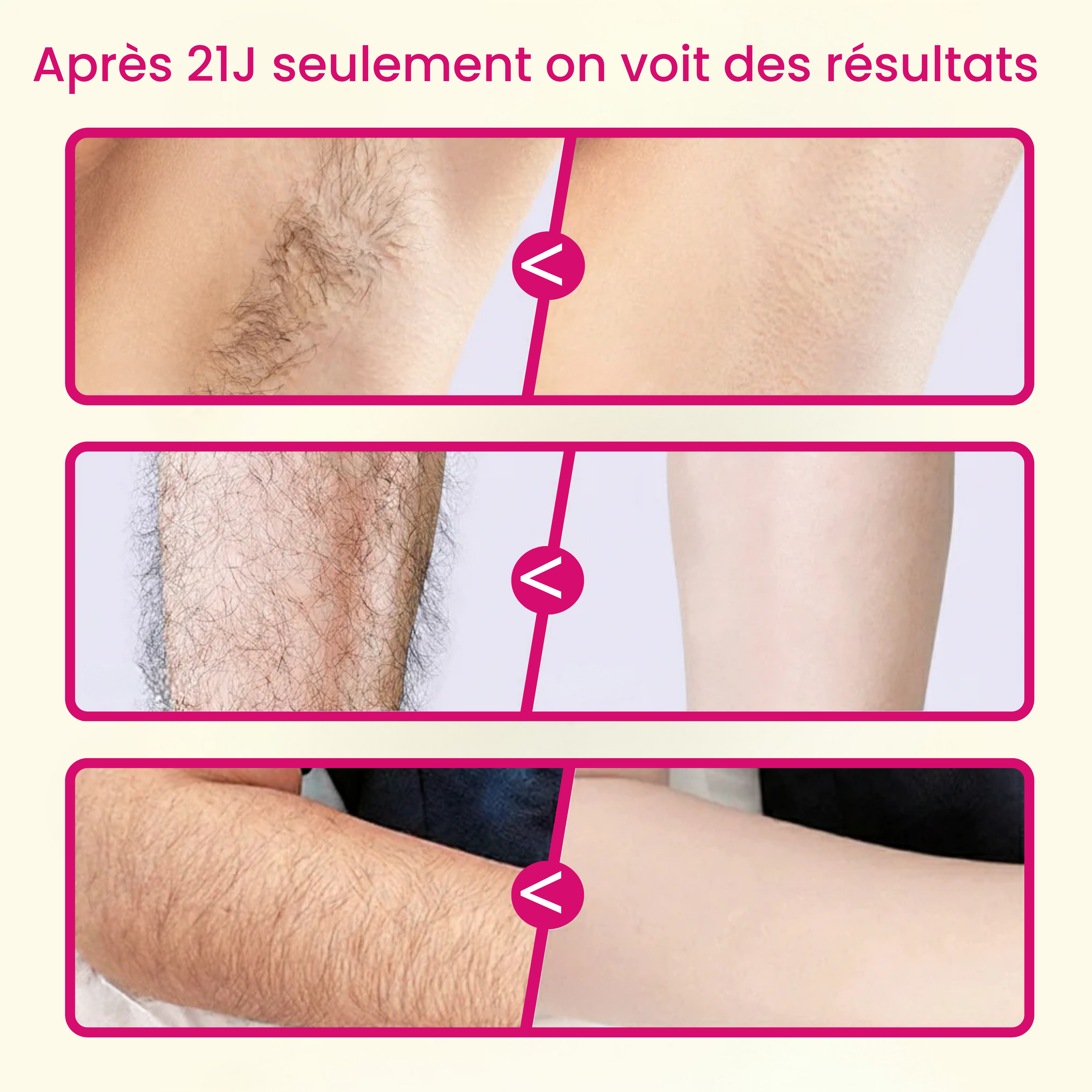 Sérum Velara : Stop-Repousse Poils & Peau de Soie