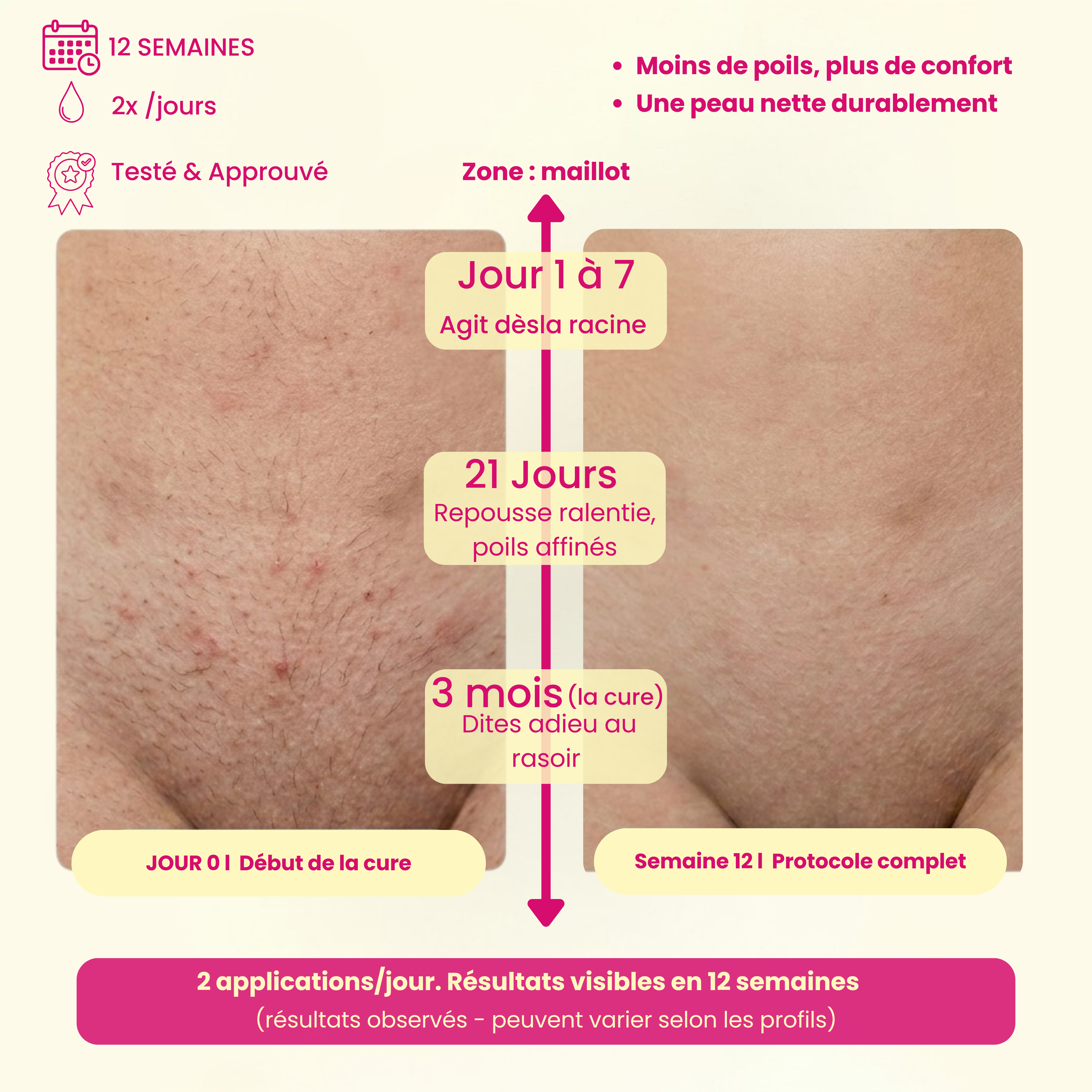 Sérum Velara : Stop-Repousse Poils & Peau de Soie